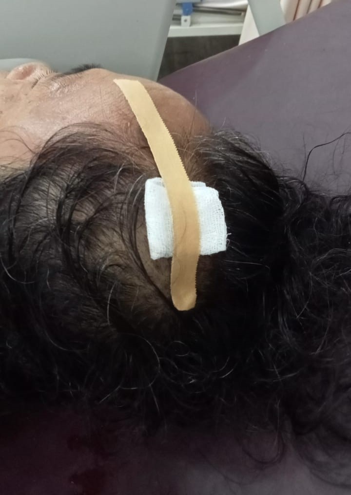 Nenek di Lampung Tengah Dianiaya Oknum Bidan, Pelaku Buron